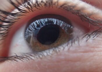 eye